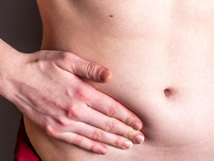 What is a Hernia?