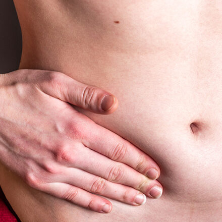 What is a Hernia?