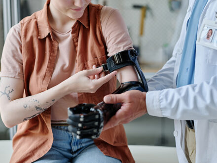 Amputation Compensation Claims – How Much Compensation Am I Eligible to Claim?
