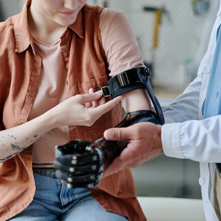 Amputation Compensation Claims – How Much Compensation Am I Eligible to Claim?