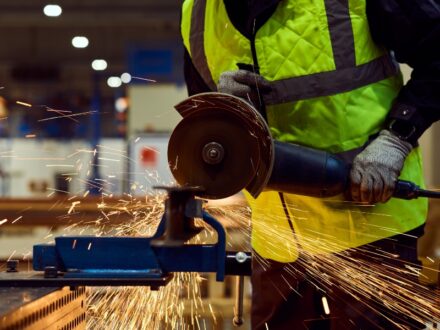 Workplace Amputation Claims – When Is Your Employer Liable?