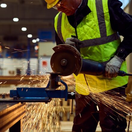 Workplace Amputation Claims – When Is Your Employer Liable?