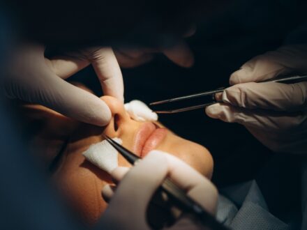 Cosmetic Surgery Compensation Claims