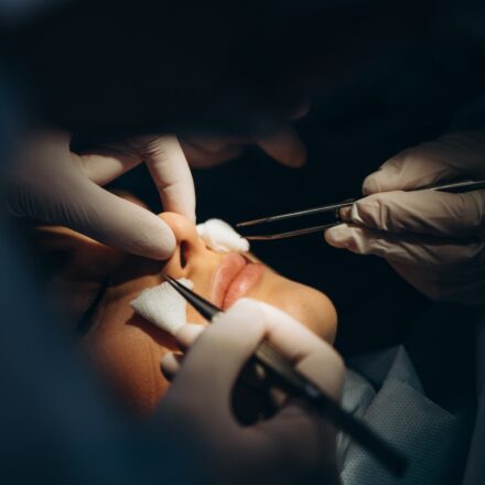 Cosmetic Surgery Compensation Claims